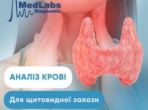 💉🩸Аналіз крові на щитовидну залозу